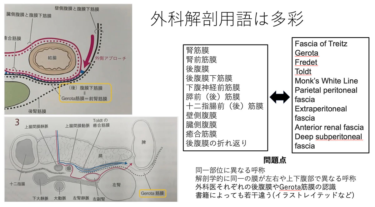 日本医科大学付属病院消化器外科論文抄読会