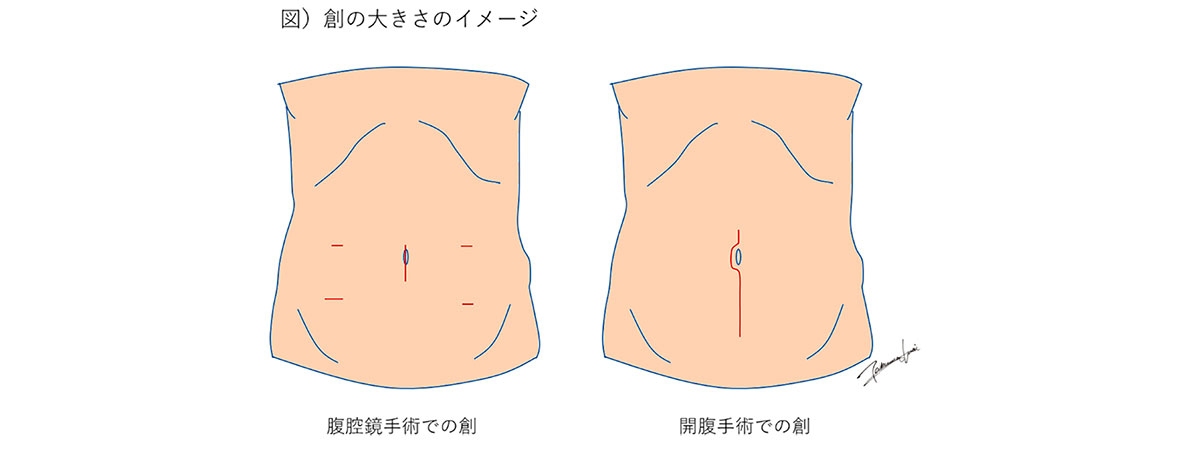 創の大きさのイメージ