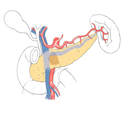 ハンズオンセミナー